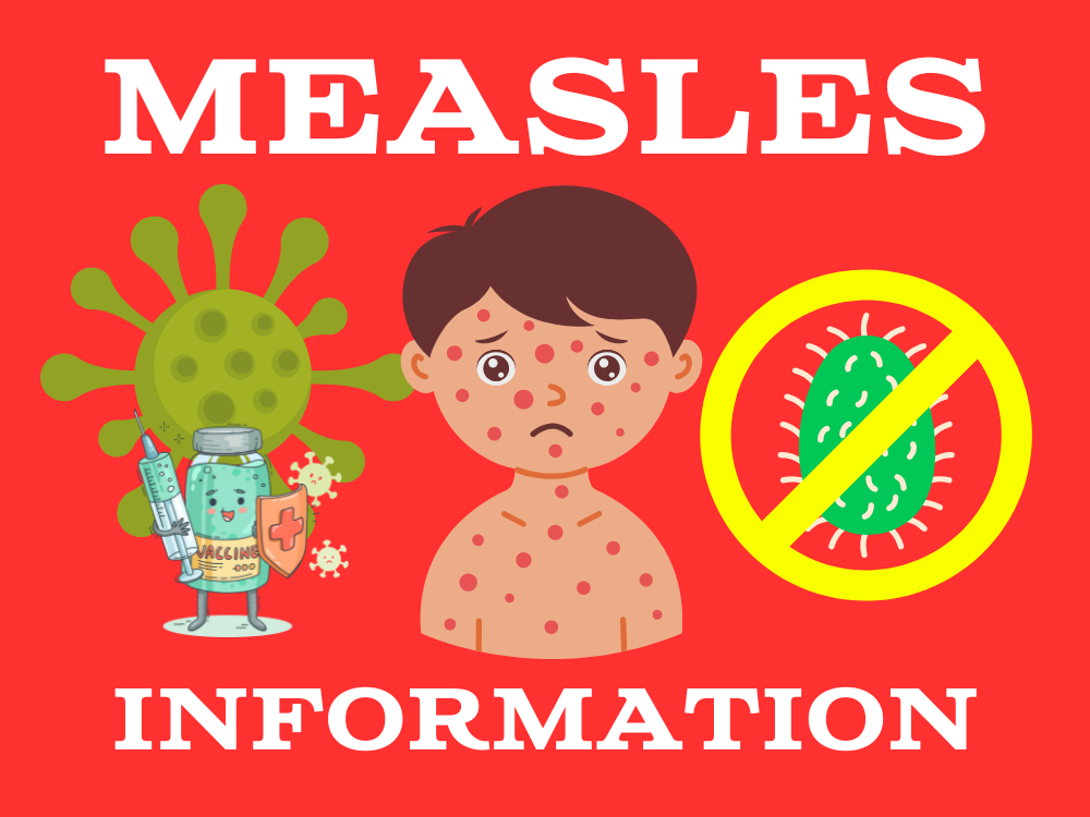 Measles Outbreak & Prevention Info